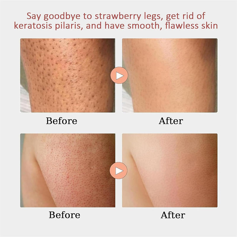Strawberry Skin Resurfacing Cream