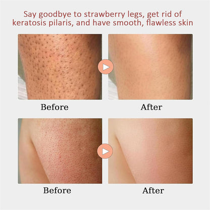 Strawberry Skin Resurfacing Cream