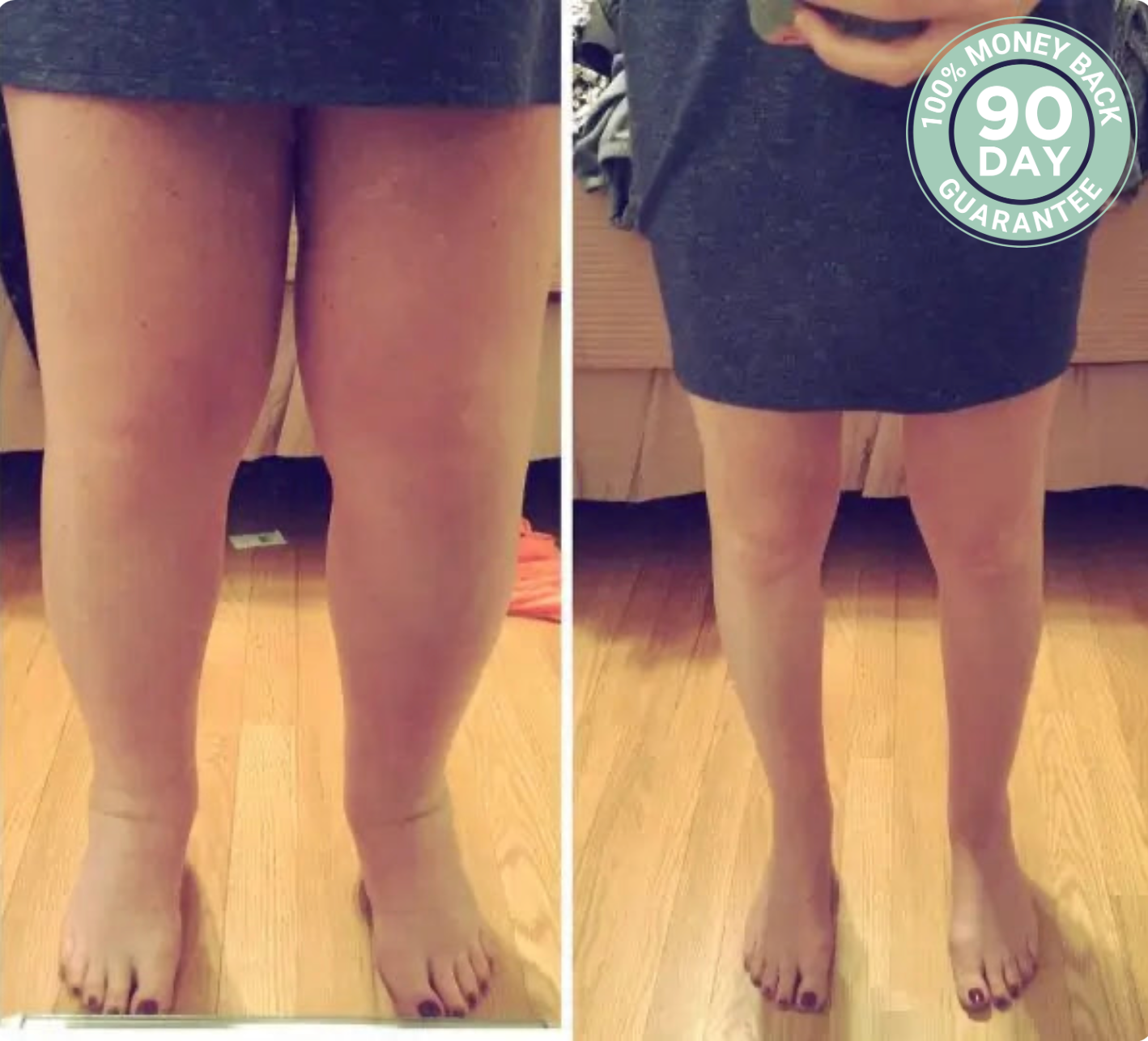 CircuRelief™ Leg Massager