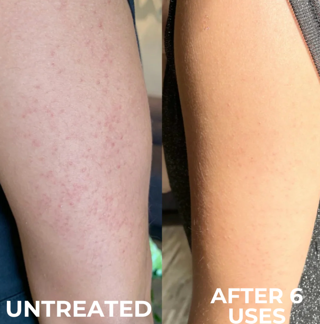 Strawberry Skin Resurfacing Cream