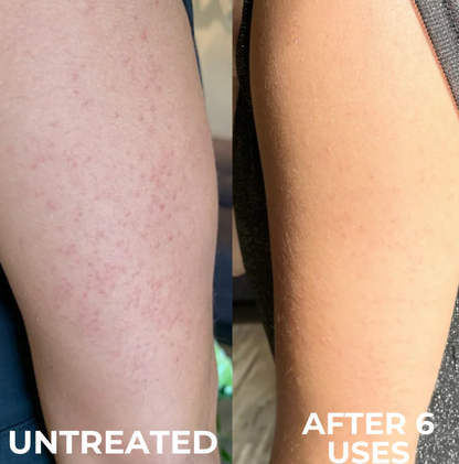 Strawberry Skin Resurfacing Cream