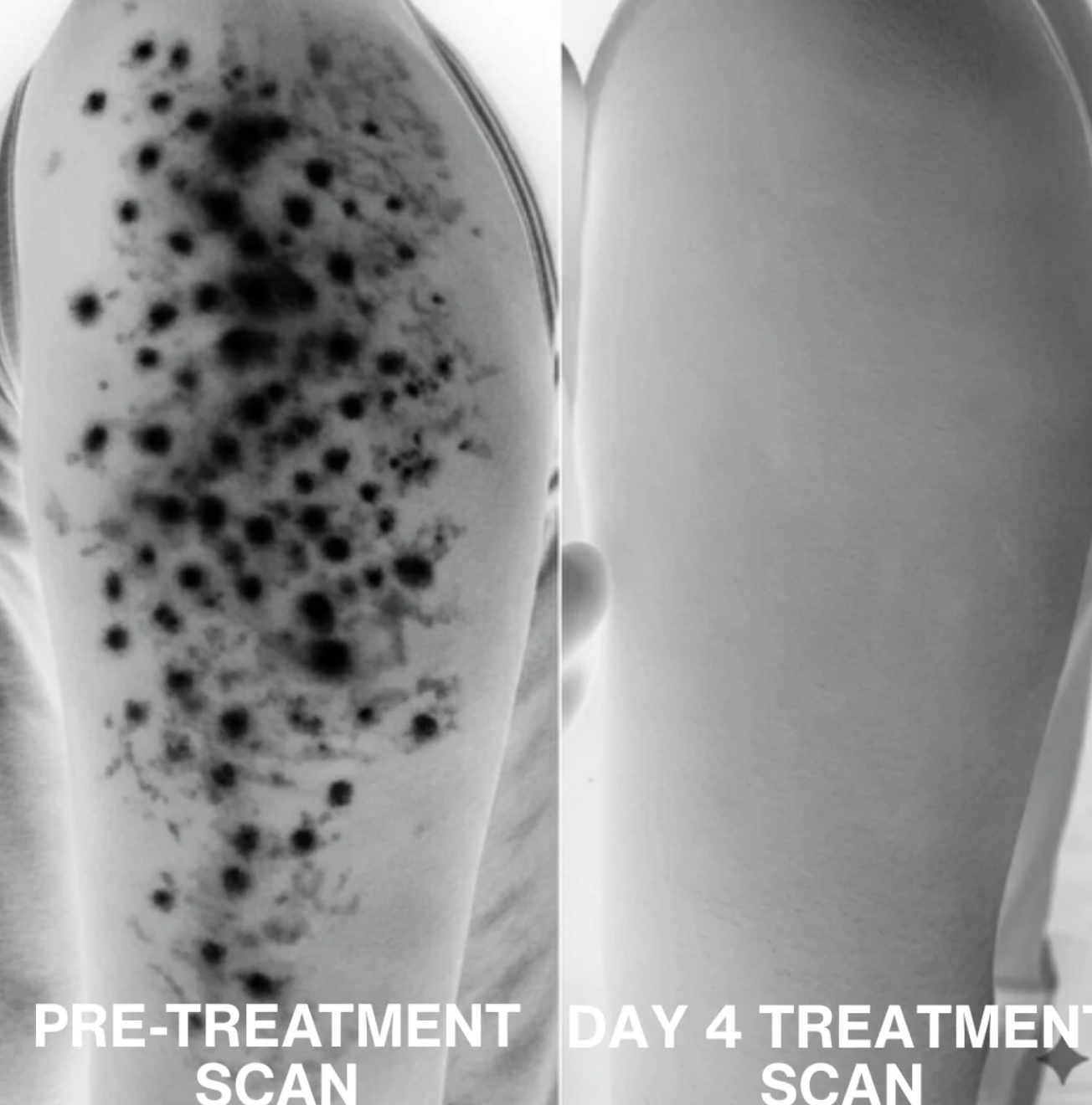 Strawberry Skin Resurfacing Cream