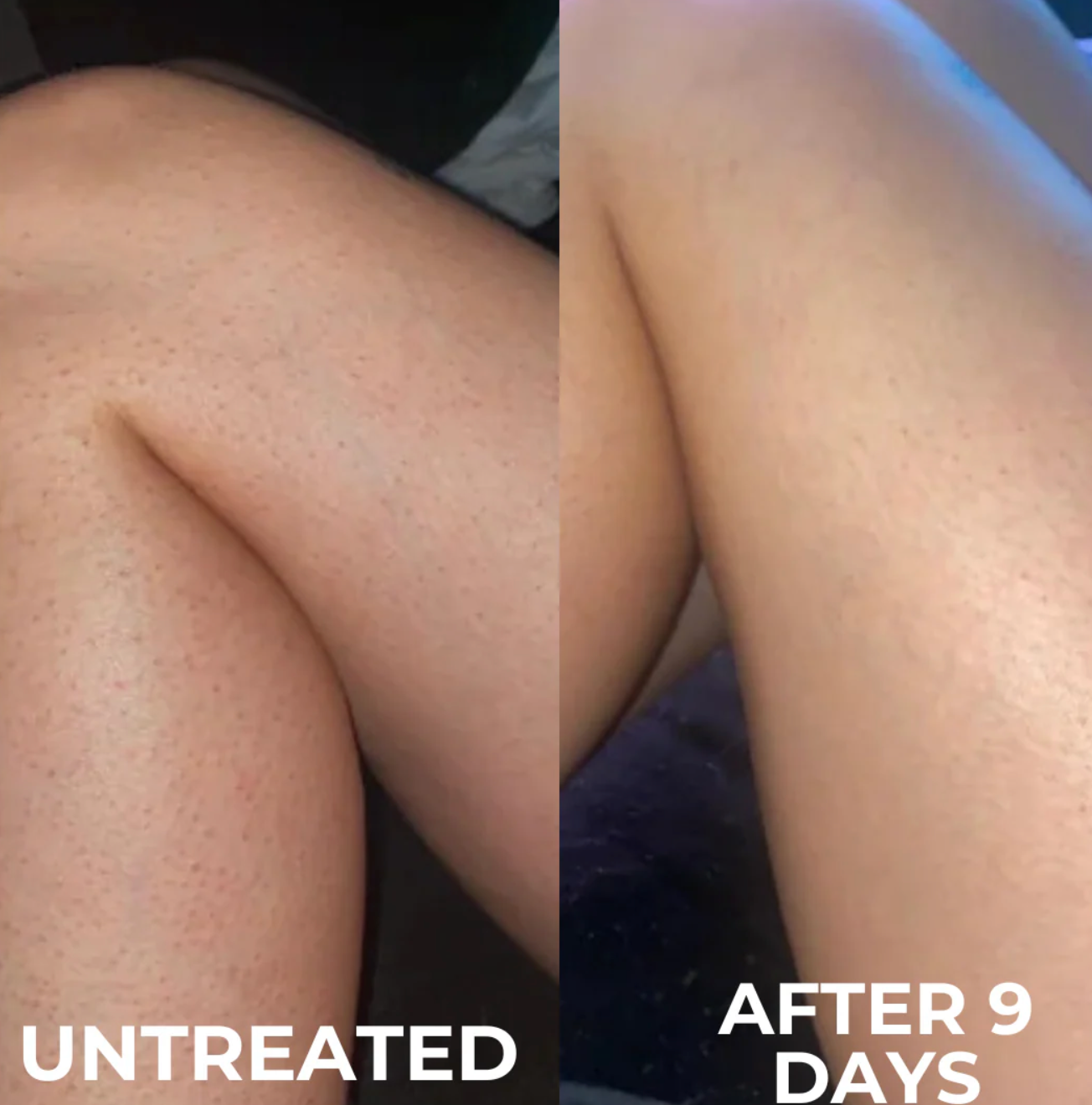 Strawberry Skin Resurfacing Cream