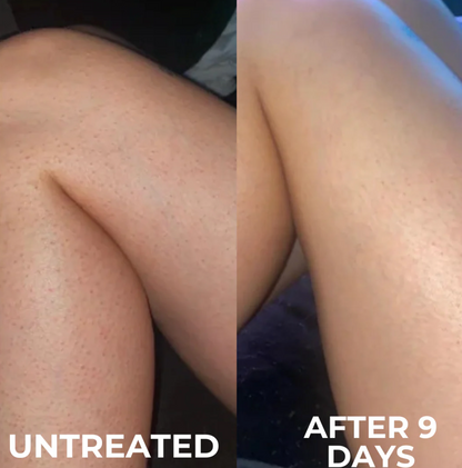 Strawberry Skin Resurfacing Cream