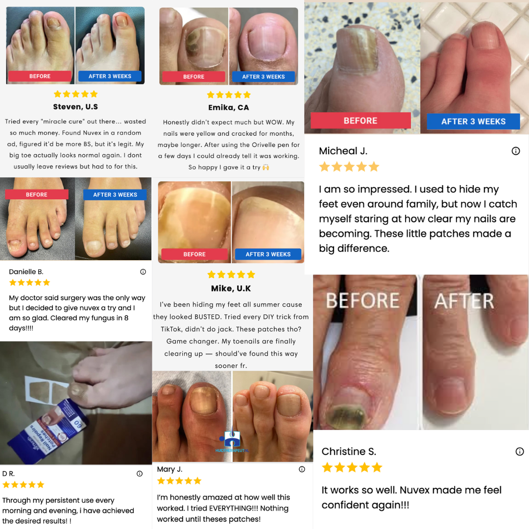 Multi-purpose Nail Repair Patches