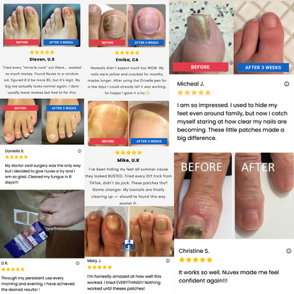 Multi-purpose Nail Repair Patches